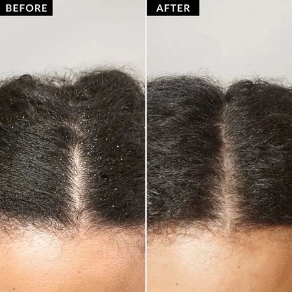 Scalp Detox Comb